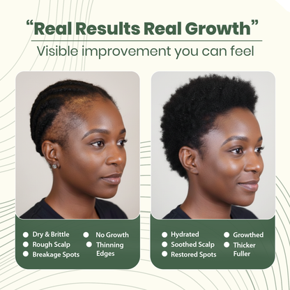 Natural Hair Growth Oil