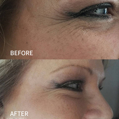 JEREMYTIS™ Anti-Wrinkle Face Tape for Frown Lines, Crow’s Feet & Smile Lines, 110 Pre-Cut Strips