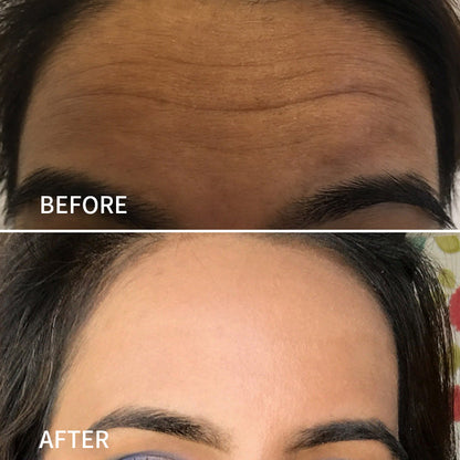 JEREMYTIS™ Anti-Wrinkle Face Tape for Frown Lines, Crow’s Feet & Smile Lines, 110 Pre-Cut Strips