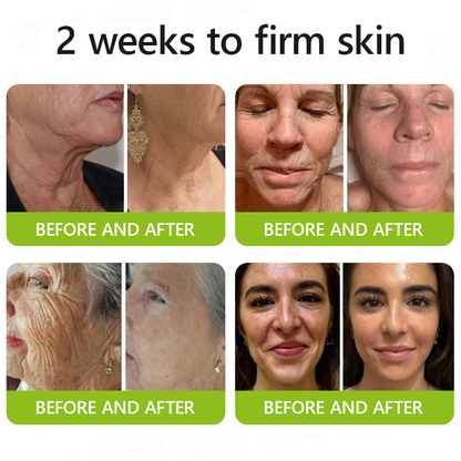 [🔥Last Day 70% OFF] ODALIT™ Botox & Retinol Shot - Eraser for Deep Wrinkles, Sagging Jowls & Puffy Eyes