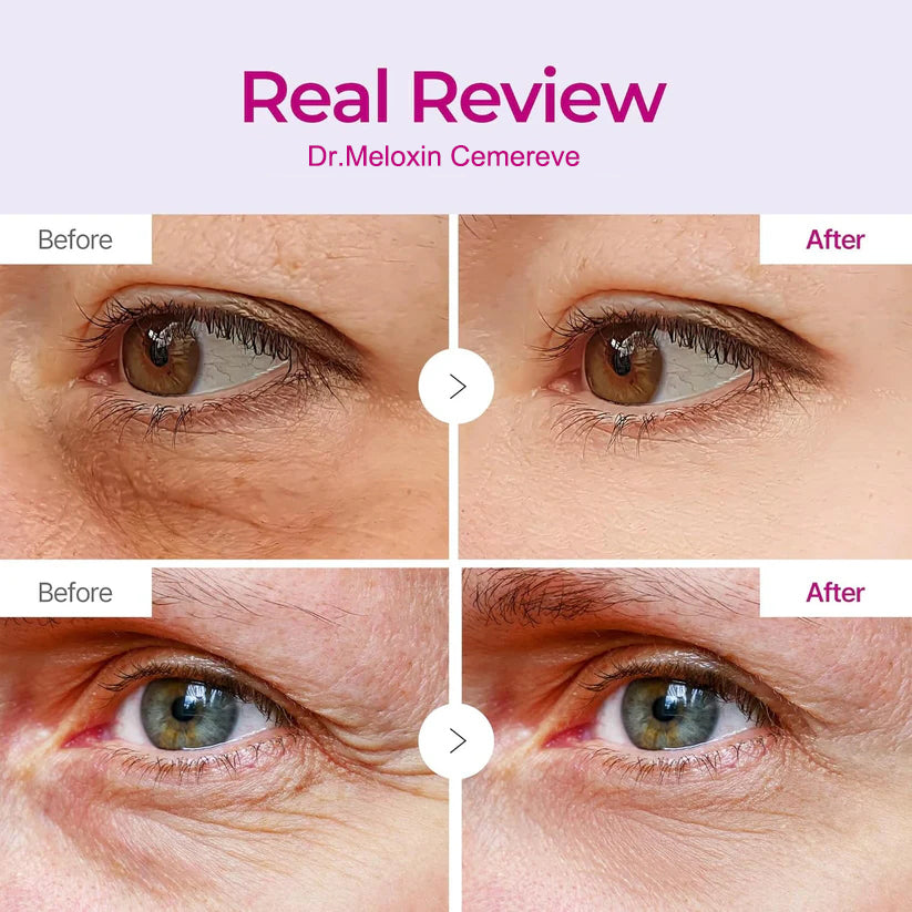 Dr.Meloxin Cemenrete Calcium Volume Eye patch 60ea
