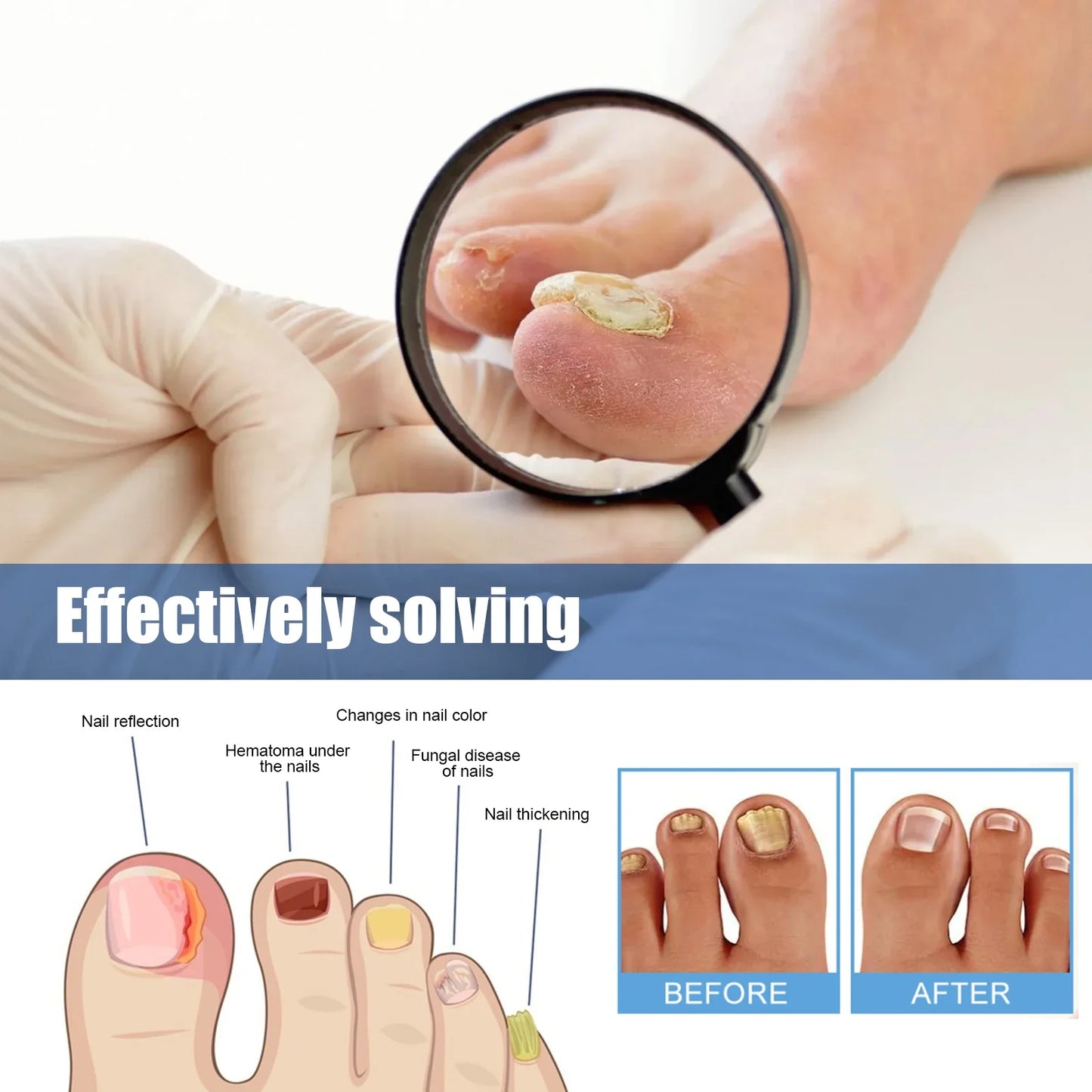 Fungus Nail Repair Patches 60pcs