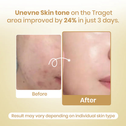 🔥 LAST DAY: 49% OFF + BOGO! JEREMYTIS™ Kojic Acid Turmeric Wrapping Mask